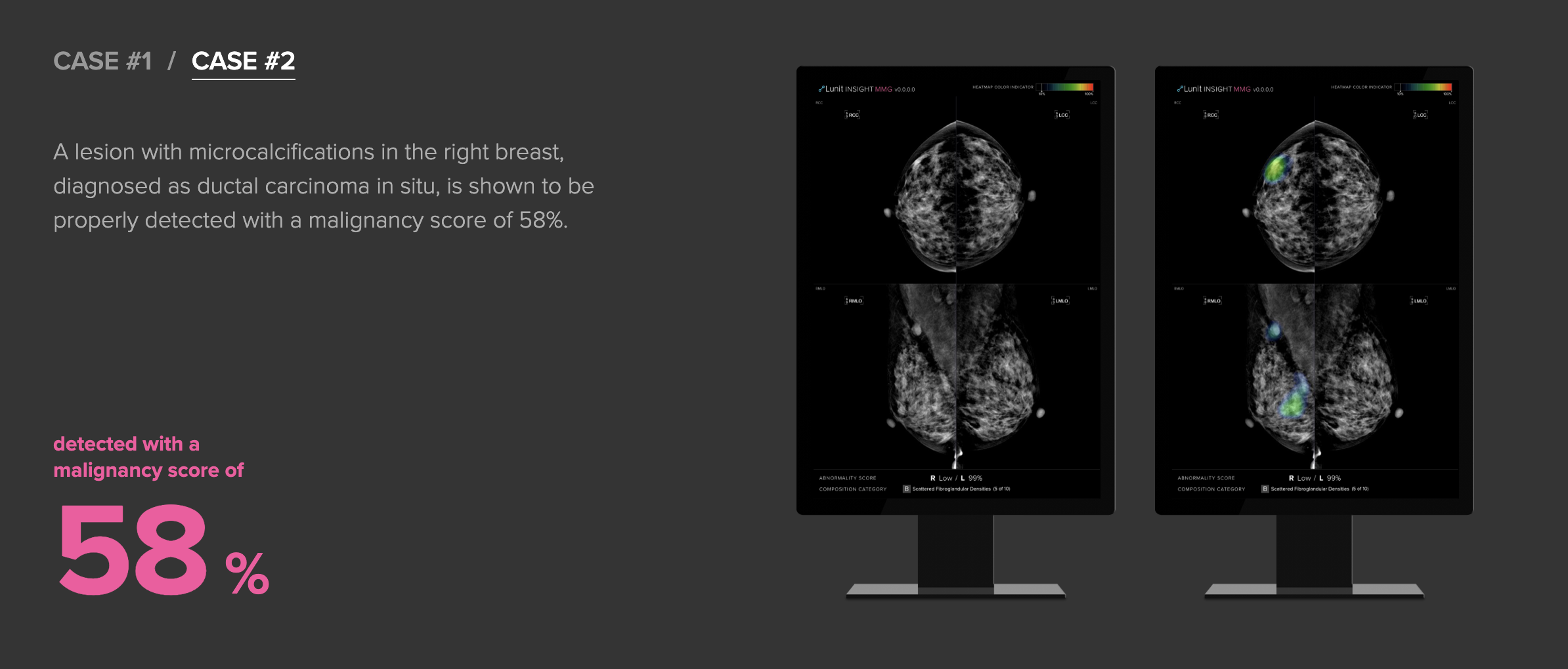 Lunit CaseStudy Mammography.png