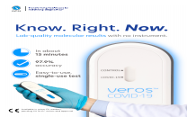 Sense Biodetection - Products, Competitors, Financials, Employees ...